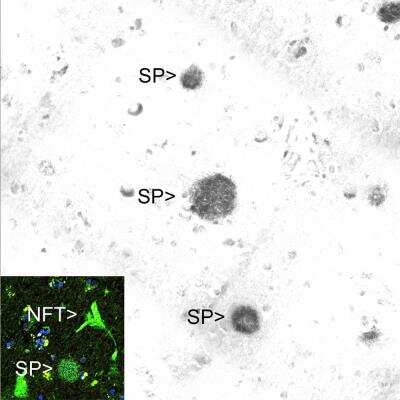 Immunohistochemistry: beta Amyloid Antibody (AB9) [NBP2-50055]