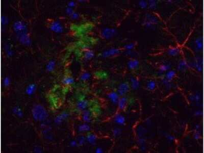 Immunohistochemistry: beta Amyloid Antibody [NBP1-78007]