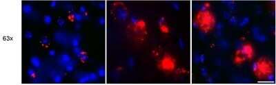 Immunocytochemistry/Immunofluorescence Staining of beta Amyloid in Mouse Subiculim
