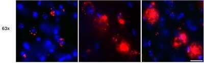 Immunocytochemistry/Immunofluorescence Staining of beta Amyloid in Mouse Subiculim