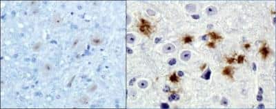 Immunohistochemical Staining of beta Amyloid in Normal and 5xFAD Mouse Brain
