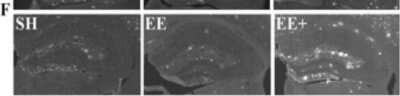 Immunohistochemical Staining of beta Amyloid in the Hippocampus of APP/PS1 Mice