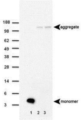 Western Blot Detection of beta Amyloid in Mouse Brain Homogenate