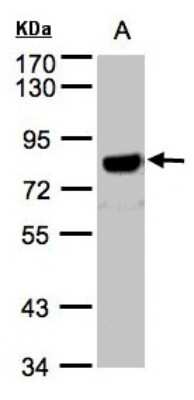 Western Blot: APP Antibody [NBP1-32081]