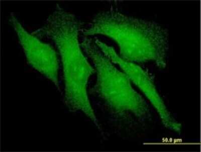 Immunocytochemistry/ Immunofluorescence: beta-Arrestin 2 Antibody (3G1) [H00000409-M01]