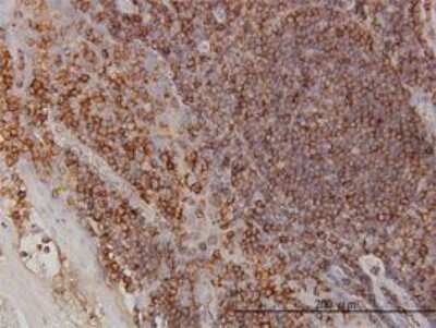 Immunohistochemistry-Paraffin: beta-Arrestin 2 Antibody (3G1) [H00000409-M01]