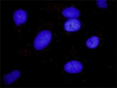 Proximity Ligation Assay: beta-Arrestin 2 Antibody (3G1) [H00000409-M01]