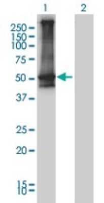 Western Blot: beta-Arrestin 2 Antibody (3G1) [H00000409-M01]
