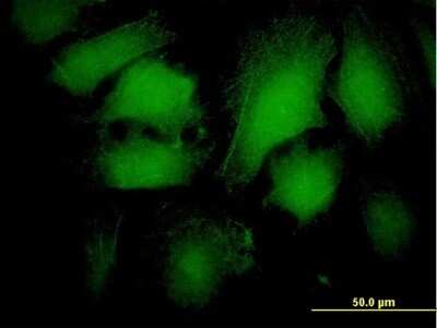 Immunocytochemistry/ Immunofluorescence: beta-Arrestin 2 Antibody (4D2) [H00000409-M06]