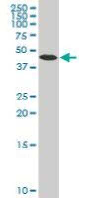 Western Blot: beta-Arrestin 2 Antibody (4D2) [H00000409-M06]