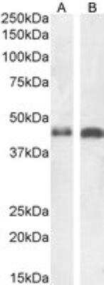 Western Blot: beta-Arrestin 2 Antibody [NB100-1515]