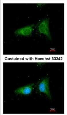 Immunocytochemistry/ Immunofluorescence: beta COP Antibody [NBP2-15578]