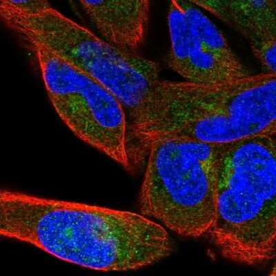 Immunocytochemistry/ Immunofluorescence: beta COP Antibody [NBP2-39027]