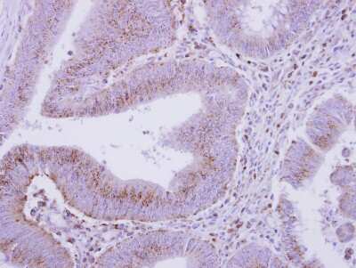 Immunohistochemistry-Paraffin: beta COP Antibody [NBP2-15577]