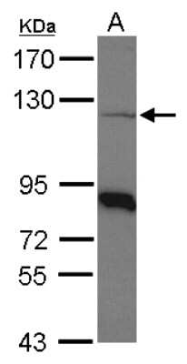 Western Blot: beta COP Antibody [NBP2-15578]