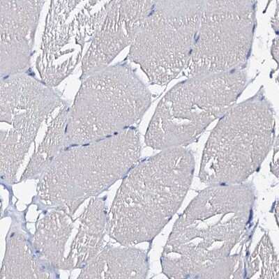 Immunohistochemistry-Paraffin: beta Casein Antibody [NBP1-88188]