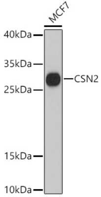 Western Blot: beta Casein AntibodyAzide and BSA Free [NBP2-92086]