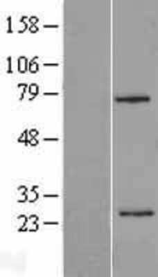 Western Blot: beta Casein Overexpression Lysate [NBP2-10770]