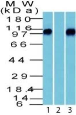 Western Blot: beta-Catenin AntibodyBSA Free [NBP2-33124]