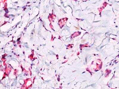 Immunohistochemistry-Paraffin: beta-Catenin Antibody - IHC-Prediluted [NBP2-48367]
