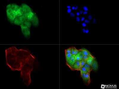 Immunocytochemistry/ Immunofluorescence: beta-Catenin Antibody (12F7) - Azide and BSA Free [NBP2-80596]
