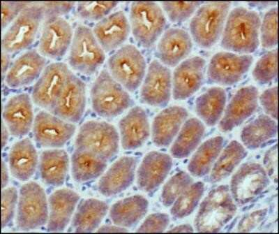 Immunocytochemistry: beta-Catenin Antibody (12F7) - Azide and BSA Free [NBP2-80596]