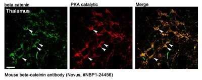 Immunohistochemistry: beta-Catenin Antibody (12F7) - Azide and BSA Free [NBP2-80596]