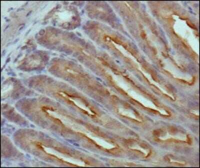 Immunohistochemistry: beta-Catenin Antibody (12F7) - Azide and BSA Free [NBP2-80596]