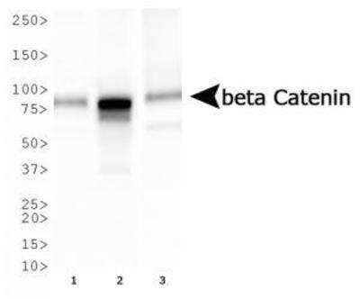 Western Blot: beta-Catenin Antibody (12F7)BSA Free [NBP1-54467]
