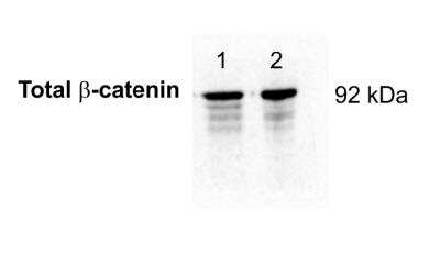 Western Blot: beta-Catenin Antibody (12F7)BSA Free [NBP1-54467]