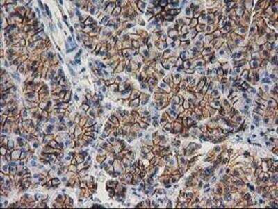 Immunohistochemistry-Paraffin: beta-Catenin Antibody (OTI12H7) [NBP2-03615]