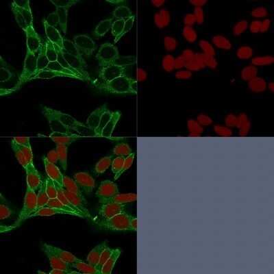 Immunocytochemistry/ Immunofluorescence: beta-Catenin Antibody (15B8) - Azide and BSA Free [NBP2-54544]