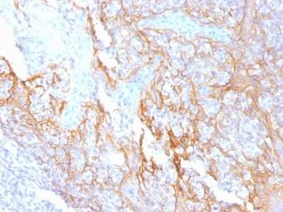 Immunohistochemistry-Paraffin: beta-Catenin Antibody (15B8) - Azide and BSA Free [NBP2-54544]