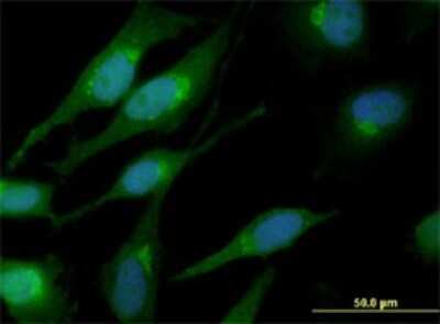 Immunocytochemistry/ Immunofluorescence: beta-Catenin Antibody (1C9) [H00001499-M02]
