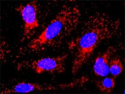 Proximity Ligation Assay: beta-Catenin Antibody (1C9) [H00001499-M02]