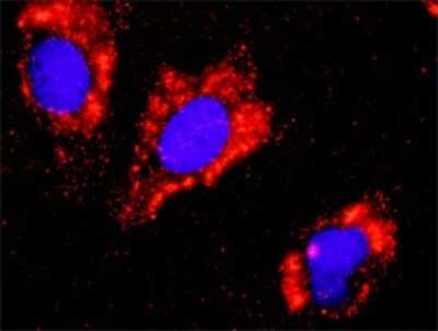 Proximity Ligation Assay: beta-Catenin Antibody (1C9) [H00001499-M02]