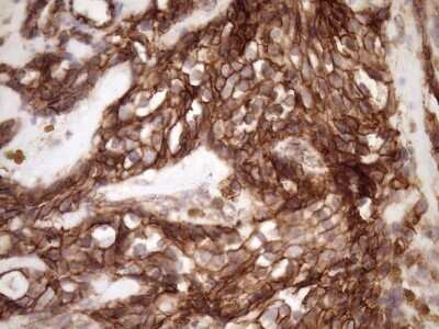 Immunohistochemistry: beta-Catenin Antibody (OTI2F10) [NBP2-46401]
