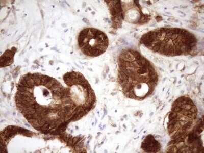 Immunohistochemistry: beta-Catenin Antibody (OTI2F10) [NBP2-46401]
