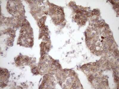 Immunohistochemistry: beta-Catenin Antibody (OTI2F10) [NBP2-46401]