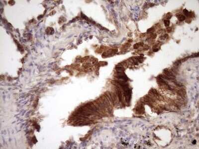 Immunohistochemistry: beta-Catenin Antibody (OTI2F10) [NBP2-46401]