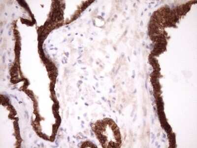 Immunohistochemistry: beta-Catenin Antibody (OTI2F10) [NBP2-46401]