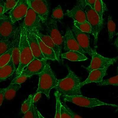 Immunocytochemistry/ Immunofluorescence: beta-Catenin Antibody (6F9) [NBP2-53360]