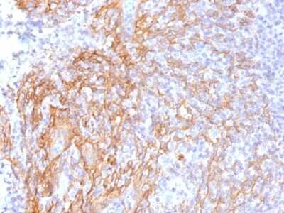 Immunohistochemistry-Paraffin: beta-Catenin Antibody (6F9) [NBP2-53360]