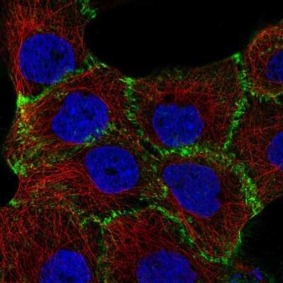 Immunocytochemistry/ Immunofluorescence: beta-Catenin Antibody (CL3689) [NBP2-61628]