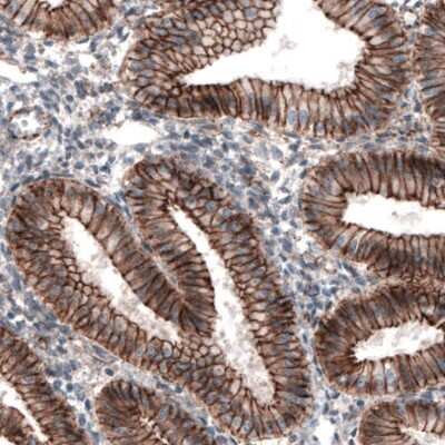 Immunohistochemistry: beta-Catenin Antibody (CL3689) [NBP2-61628]