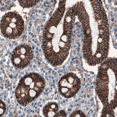 Immunohistochemistry: beta-Catenin Antibody (CL3689) [NBP2-61628]