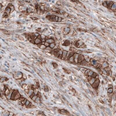 Immunohistochemistry-Paraffin: beta-Catenin Antibody (CL3689) [NBP2-61628]