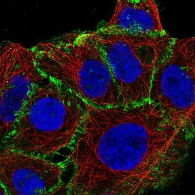 Immunocytochemistry/ Immunofluorescence: beta-Catenin Antibody (CL3691) [NBP2-61629]