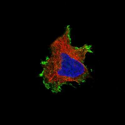 Immunocytochemistry/ Immunofluorescence: beta-Catenin Antibody (CL3691) [NBP2-61629]