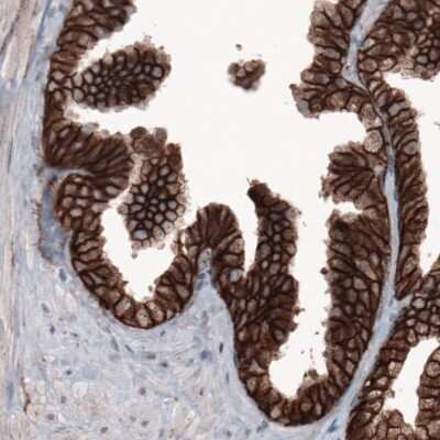 Immunohistochemistry: beta-Catenin Antibody (CL3691) [NBP2-61629]